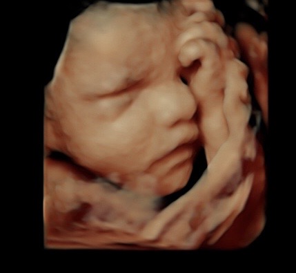 30-week-ultrasound-3.jpg